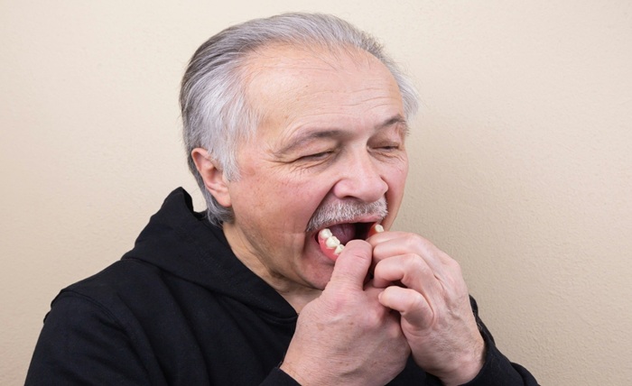 Denture Repair