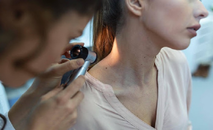 Dermatological Treatments